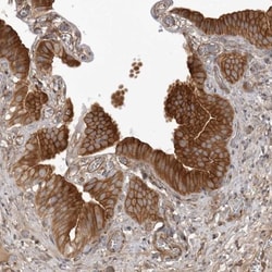 ARL5A Antibody, Novus Biologicals 25 &mu;L; Unlabeled:Antibodies, Polyclonal